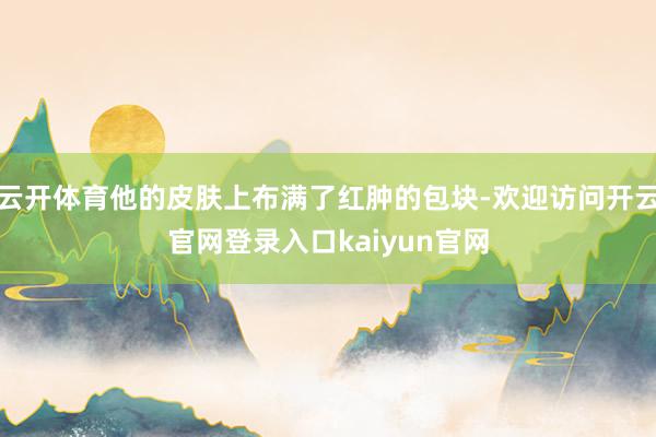 云开体育他的皮肤上布满了红肿的包块-欢迎访问开云官网登录入口kaiyun官网